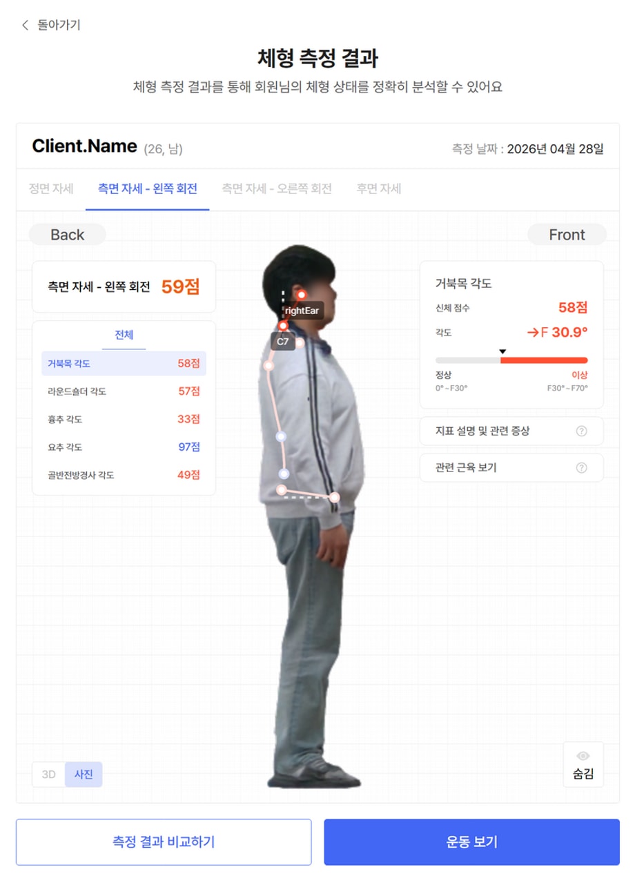 거북목 각도