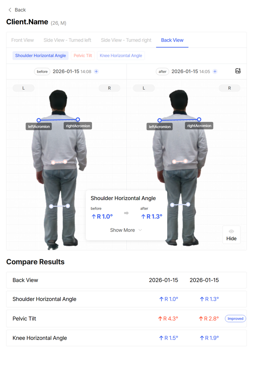 Bodydot - Before and After