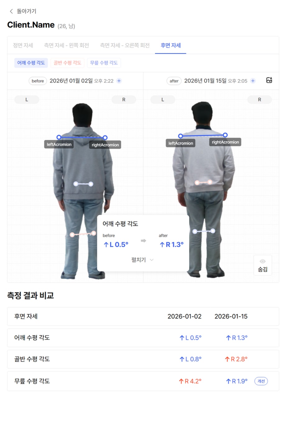 전후 비교 데이터