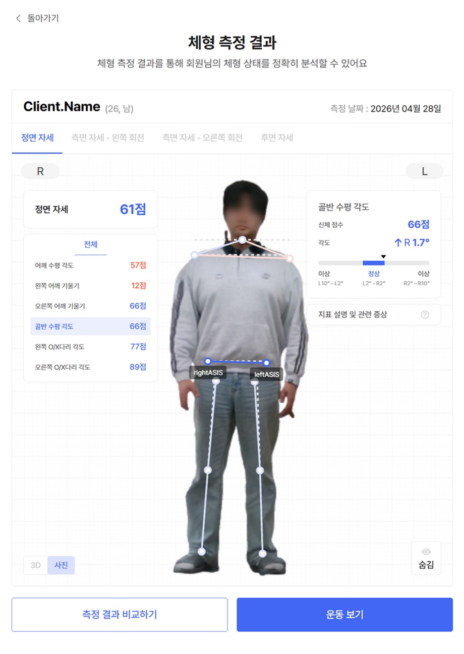 골반 수평 각도