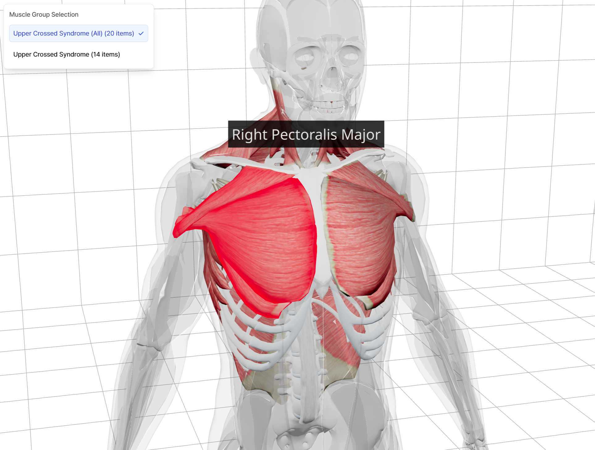 Example, 3D Model - Right Pectoralis Major