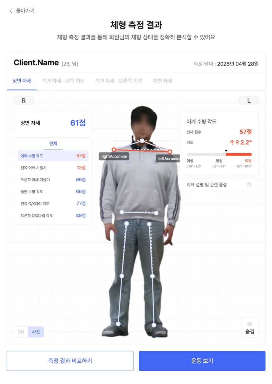 어깨 수평 각도