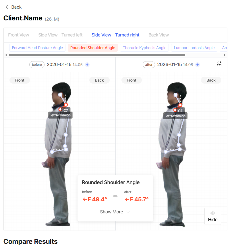 Before and After(Side view)
