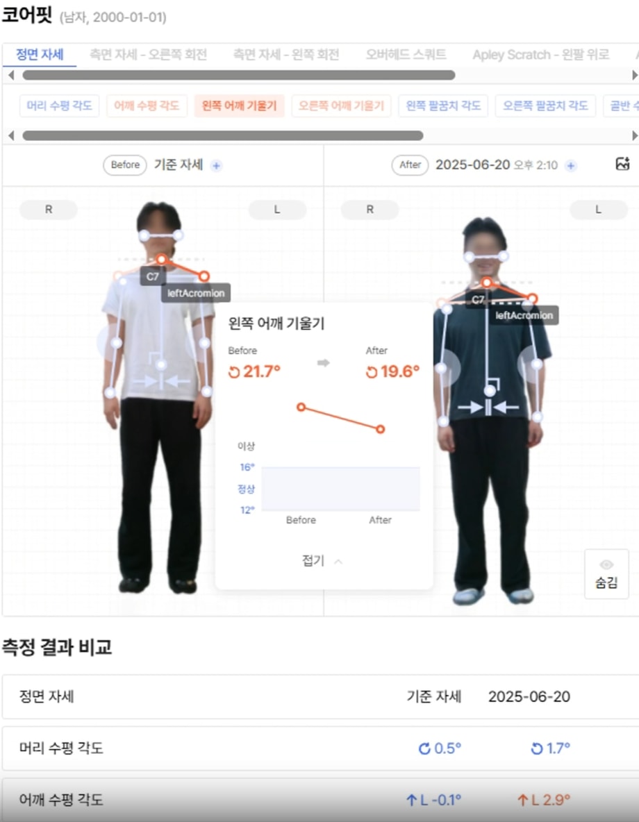 바디닷 - 전후비교