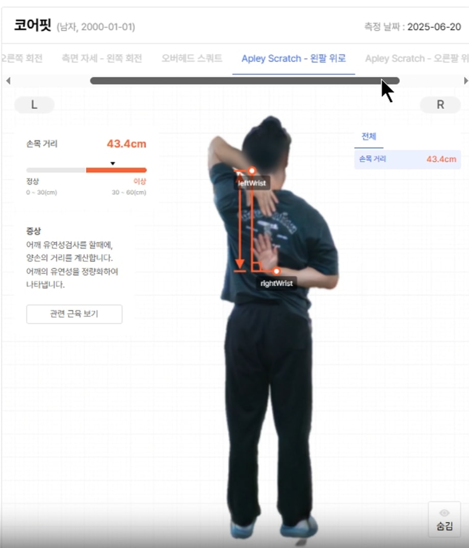 바디닷 - Appley Scratch