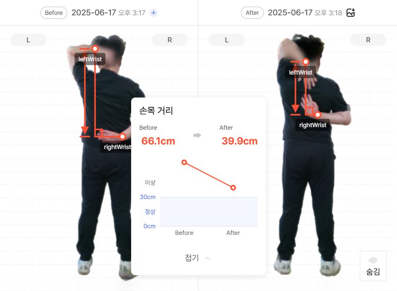어깨 유연성 검사 전후 비교