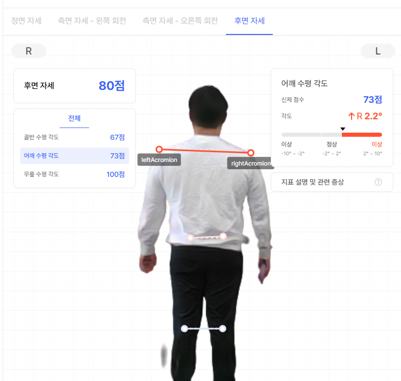 후면 자세