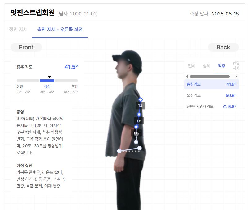 바디닷 - 흉추 각도