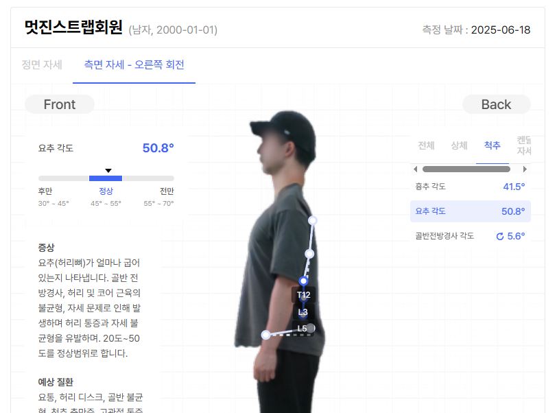 바디닷 - 요추 각도