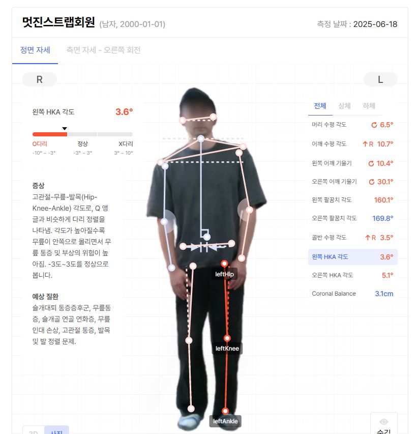 바디닷 - HKA 각도