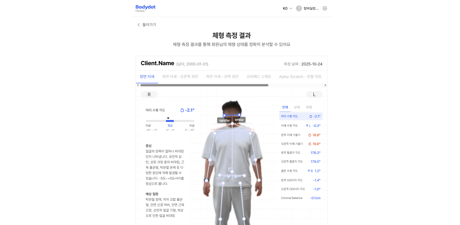 관련 근육 보기 예시