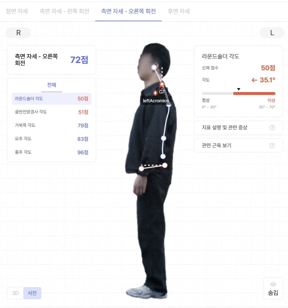 바디닷 피트니스로 분석한 체형 불균형