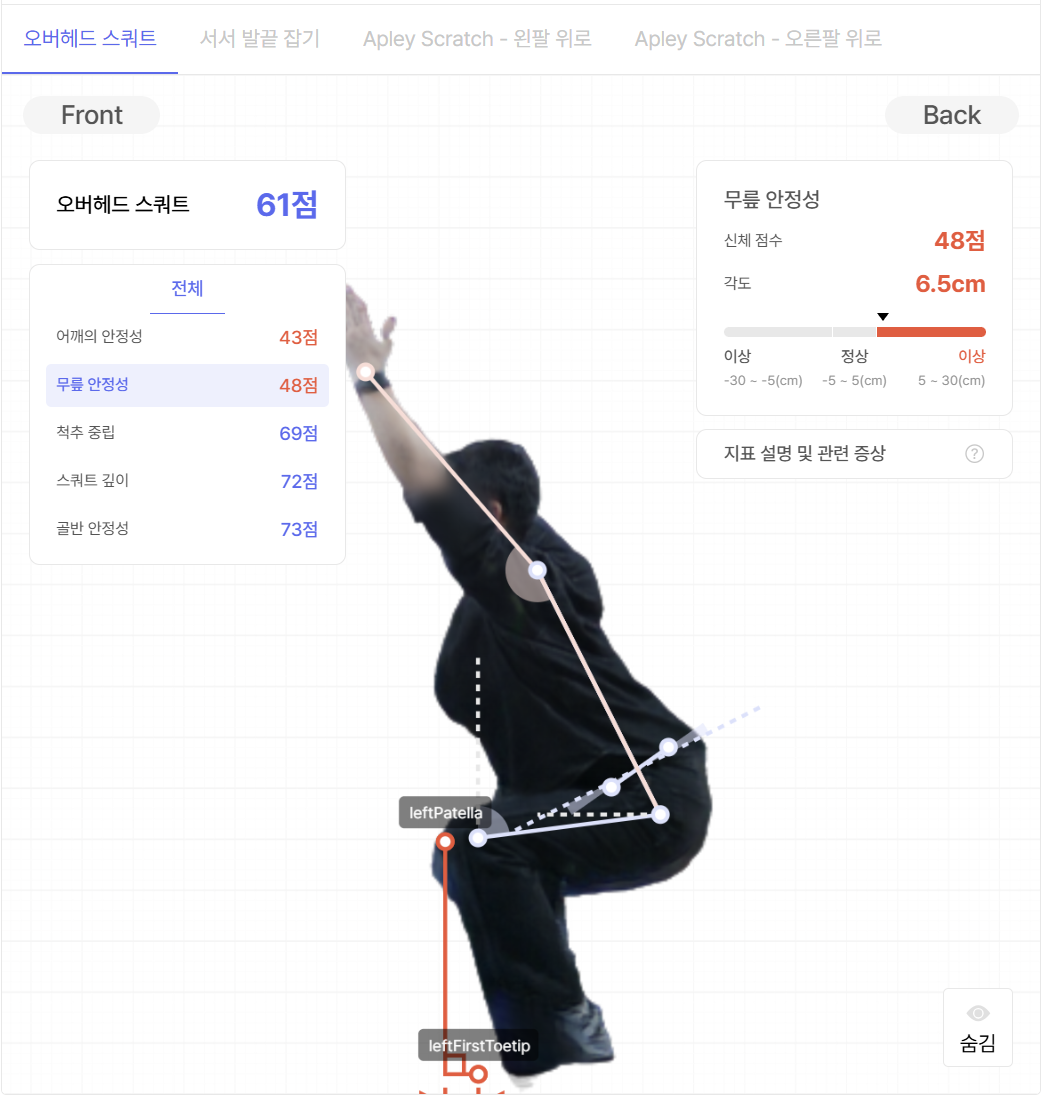 무릎 안정성 지표