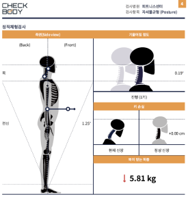 결과리포트 측면 거북목, 라운드 숄더