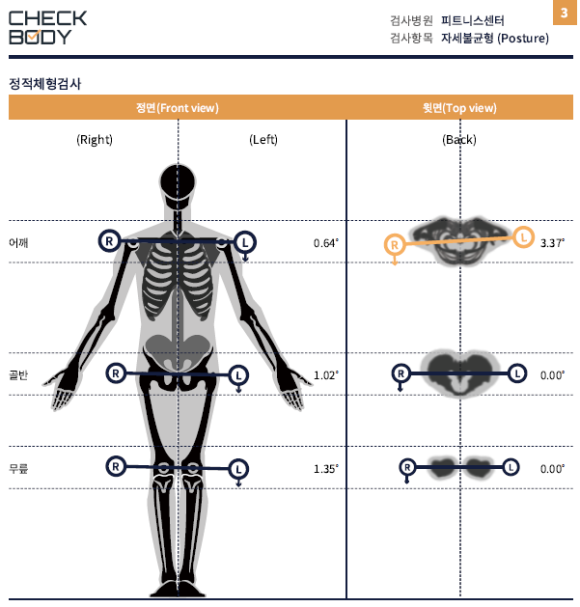 결과리포트 상하좌우 밸런스