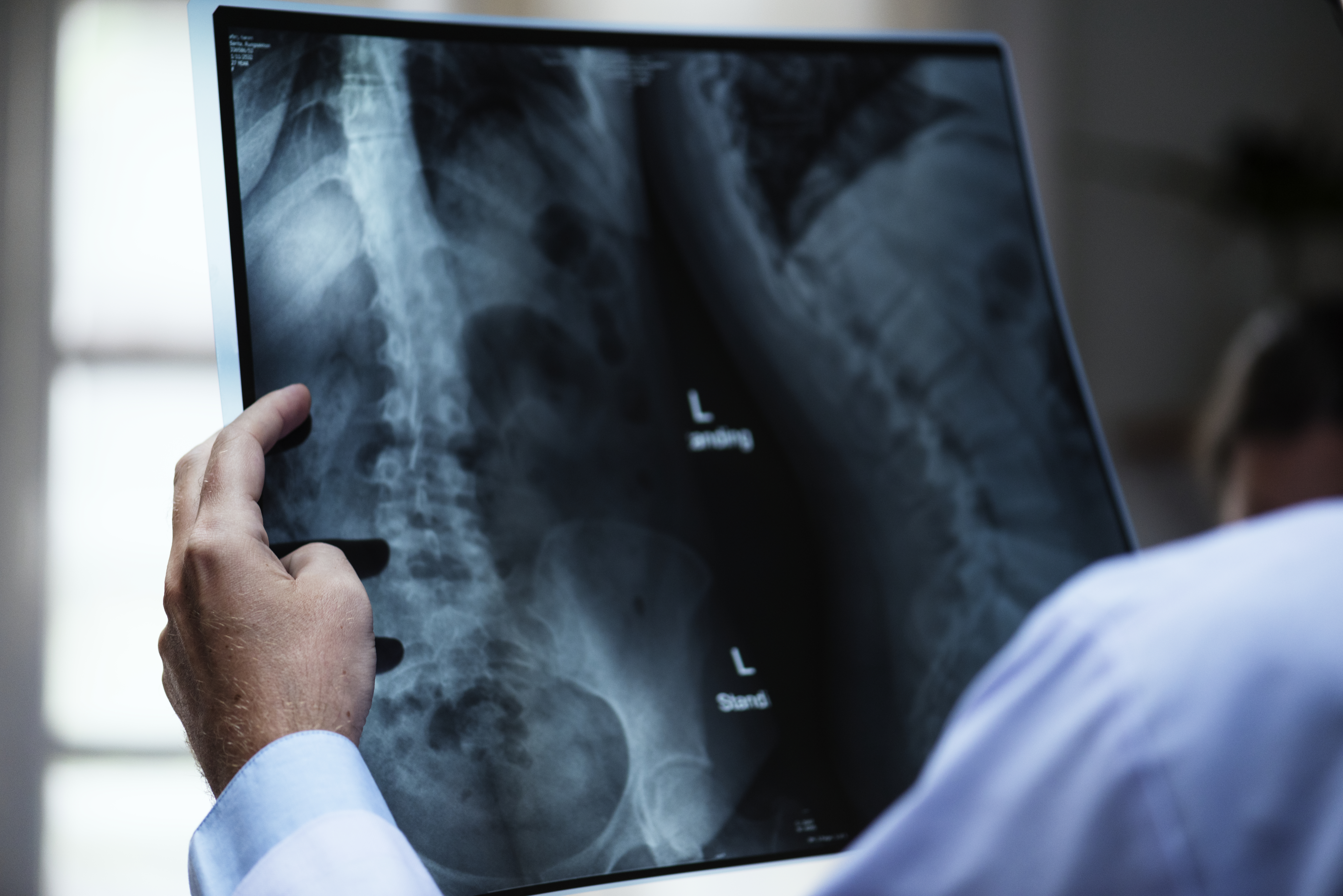 X-ray picture