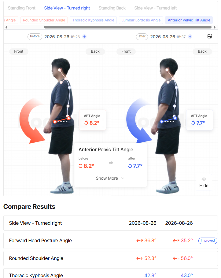 Compare posture data