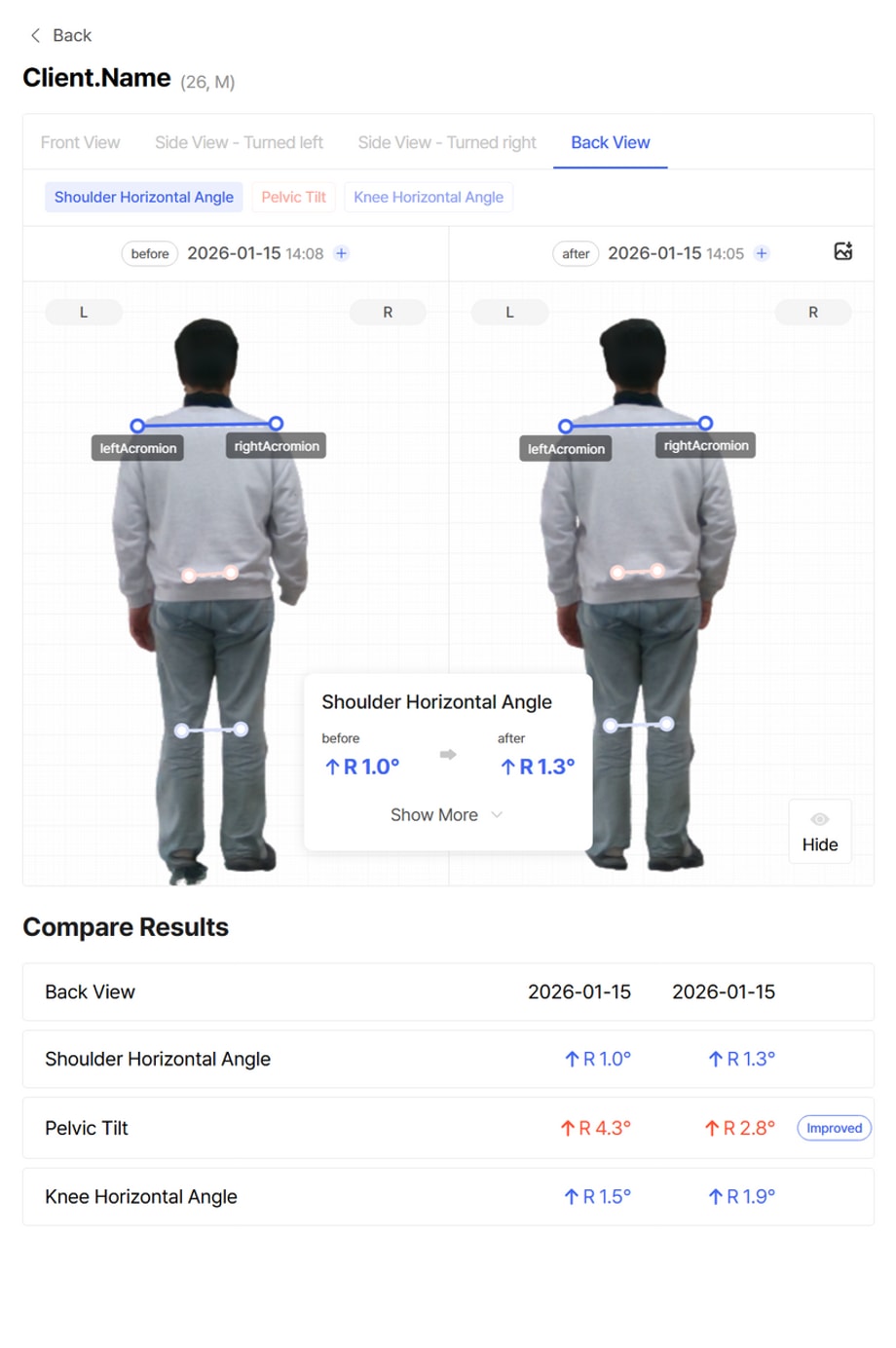 Bodydot - Before and After