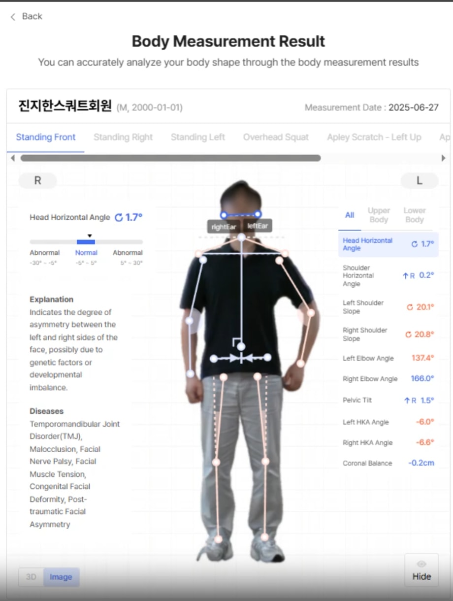 Bodydot posture report showing a front-view scan with alignment markers and measurement metrics.