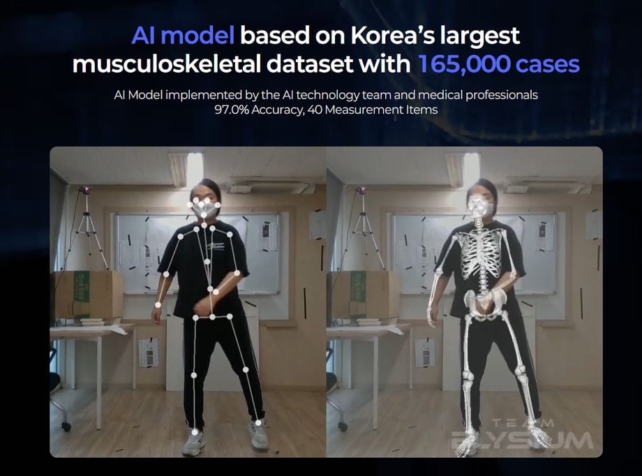 AI posture analysis overlays alignment points and a skeleton on a standing man.