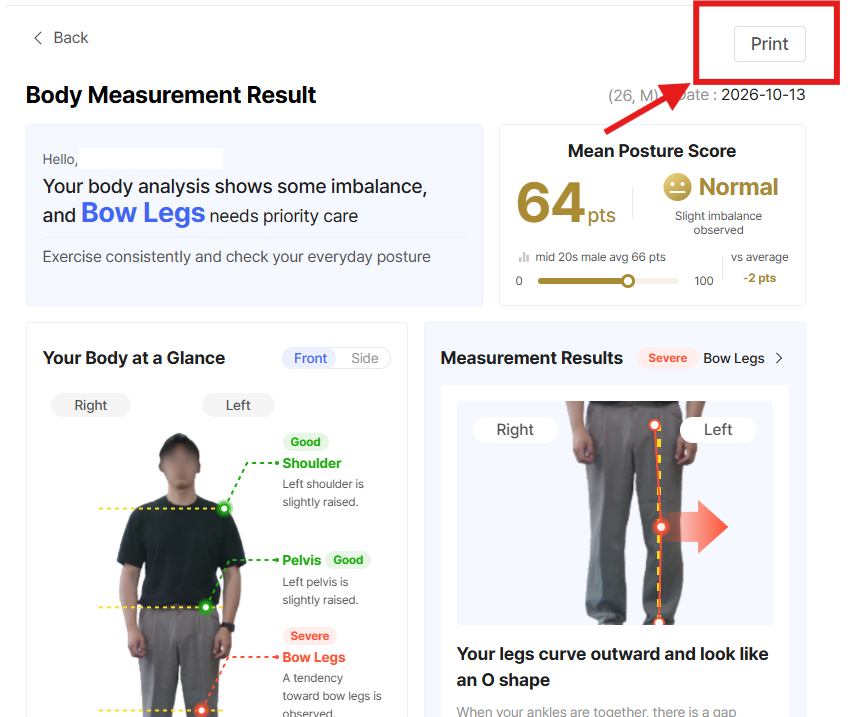 Print feature added to the Bodydot Quick Posture Test report