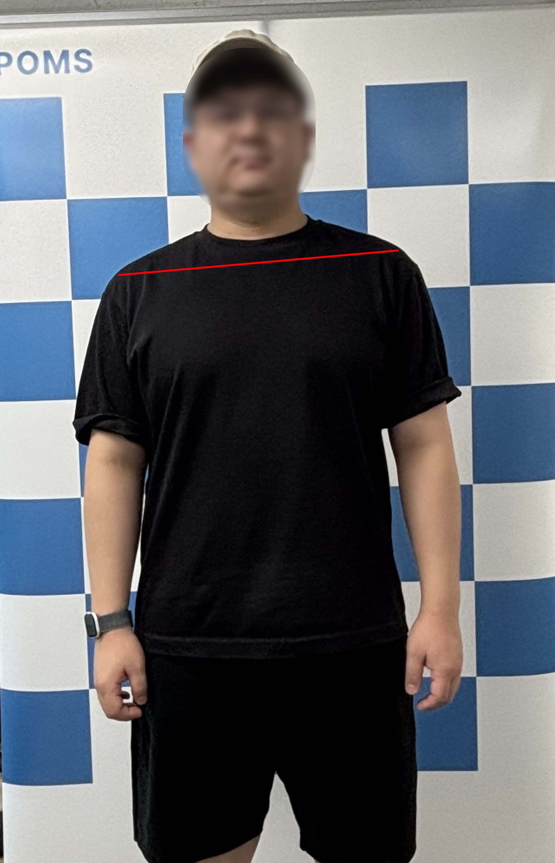 A person photographed for a posture assessment from one camera angle.