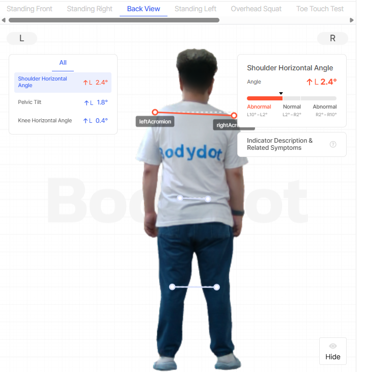 Bodydot Analysis Report (Back View)