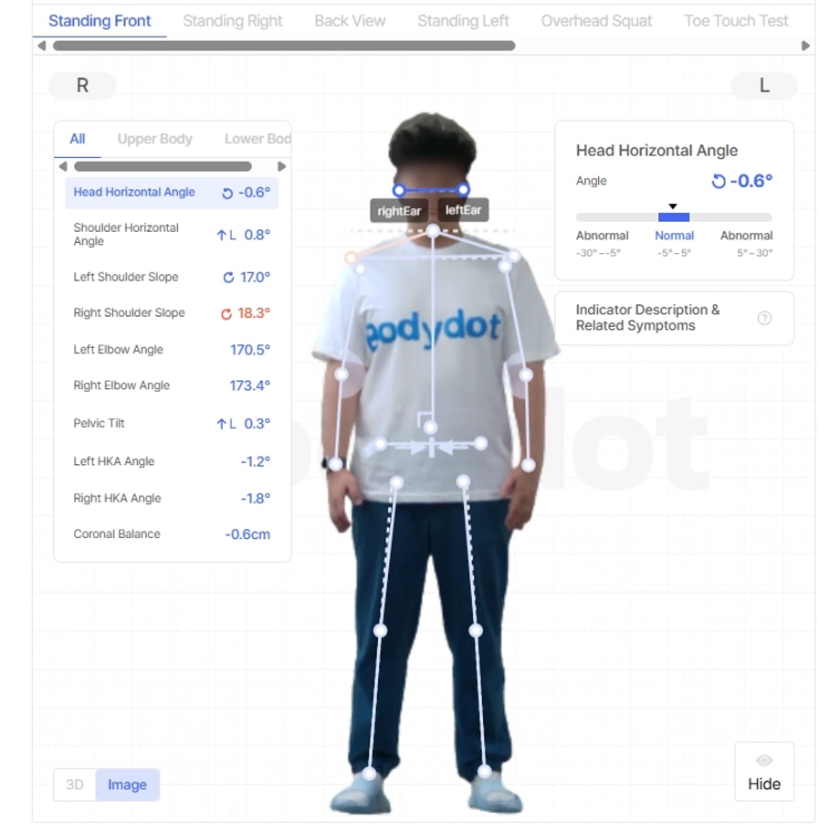 Bodydot Analysis Report (Front View)