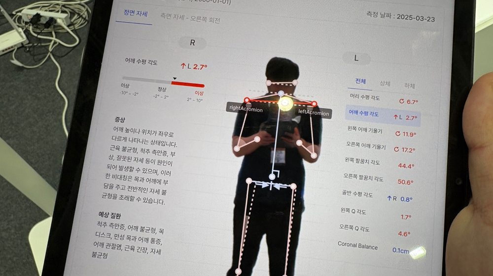 체형분석 리포트 예시