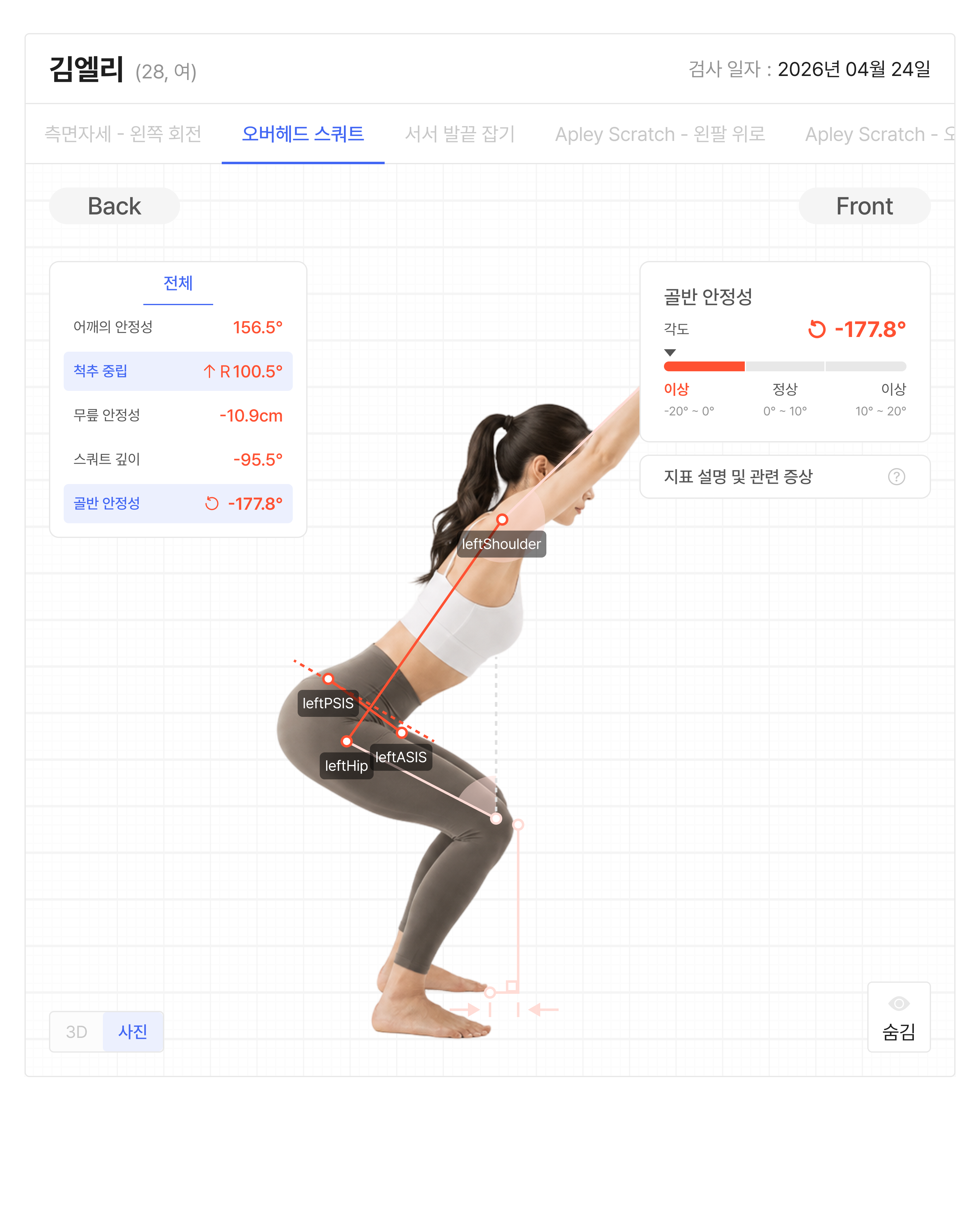 notion image