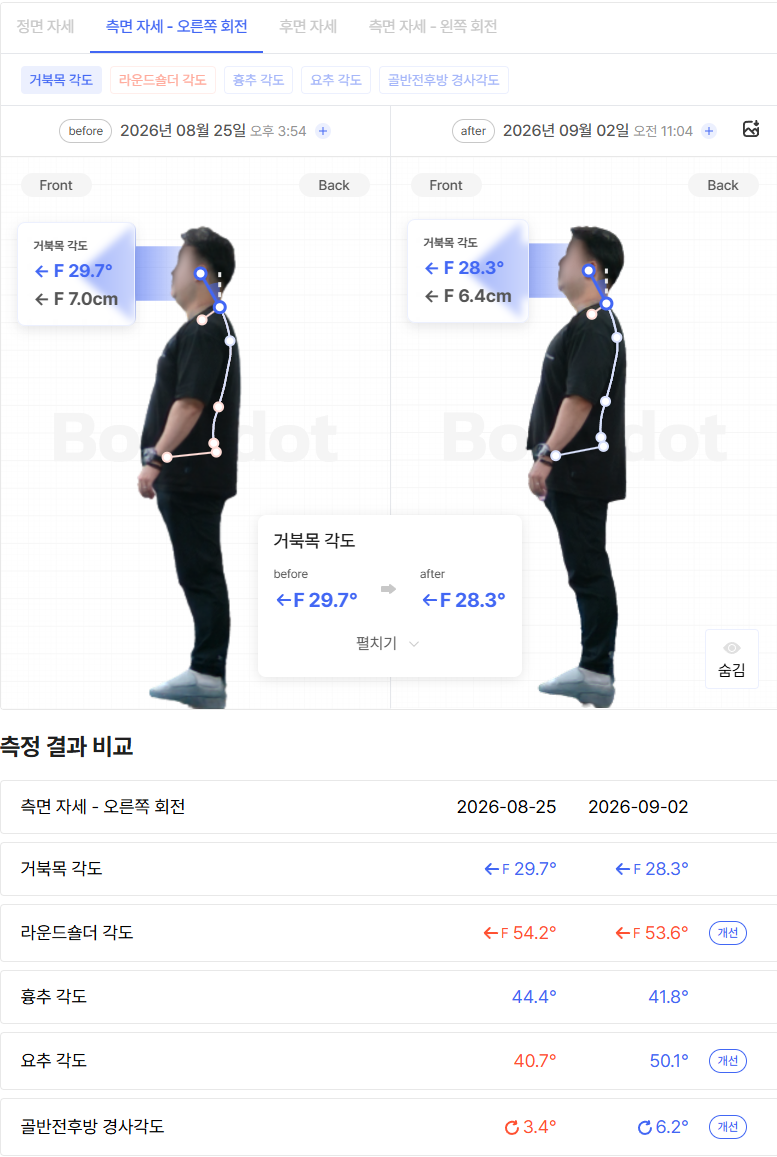 바디닷 비포 애프터 비교 결과지
