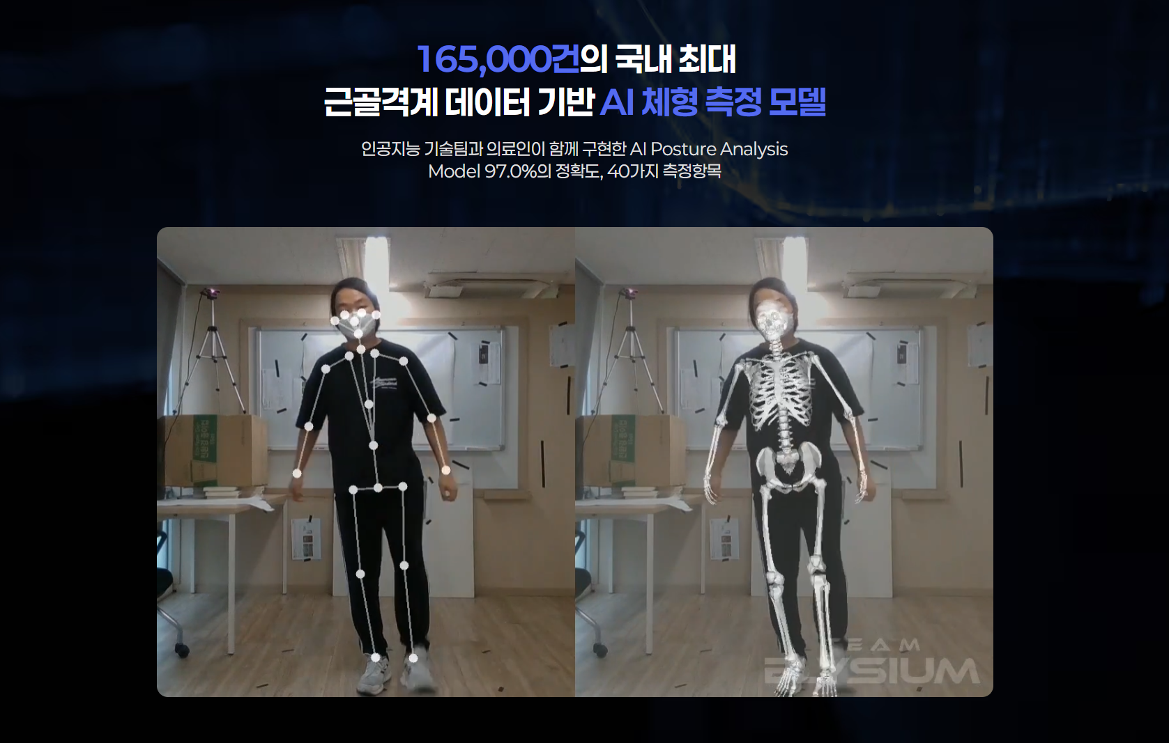 97%의 정확도로 뼈의 위치를 인식합니다.