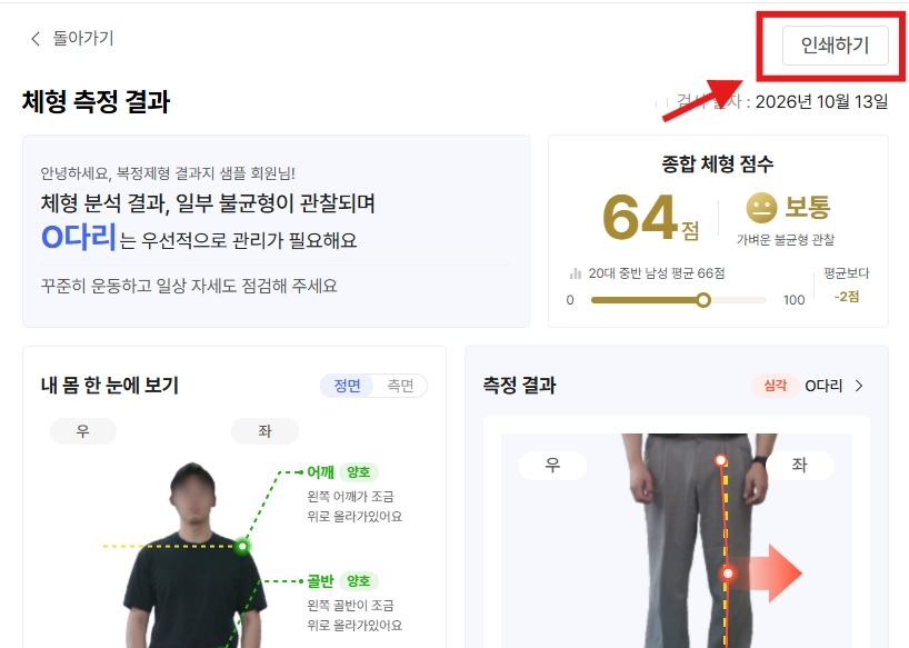 바디닷 빠른자세 검사 리포트 인쇄 기능 추가