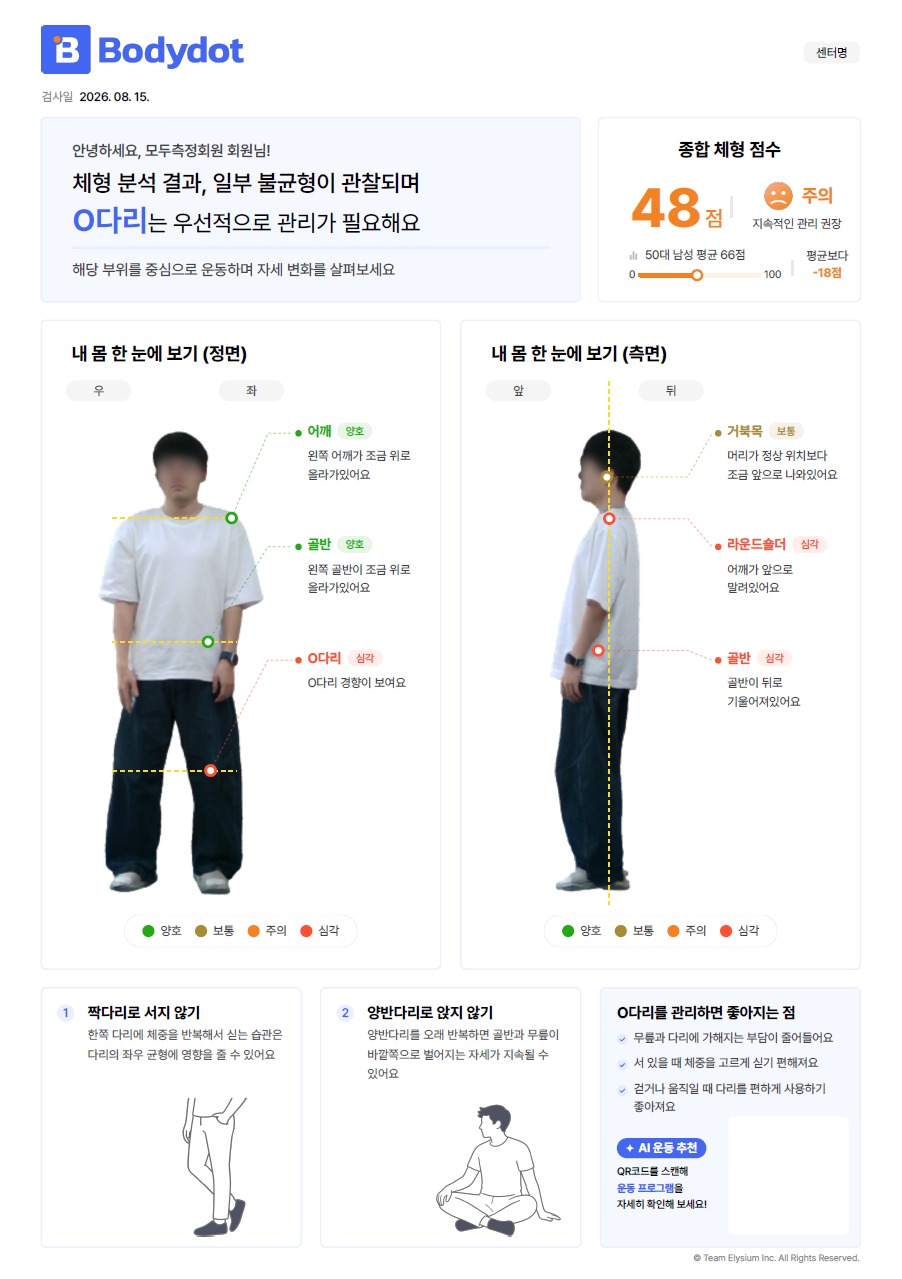 바디닷 빠른자세 검사 리포트 결과지 인쇄