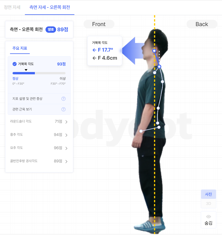 거북목 각도