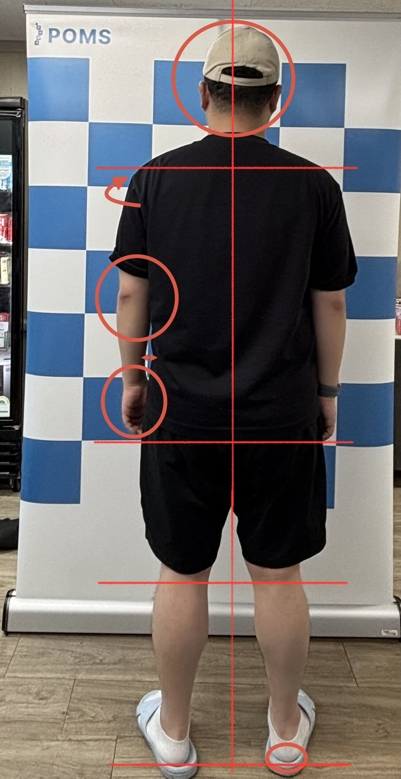 체형 불균형을 표시한 사진