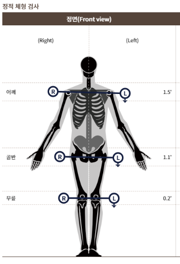 치료 후 체형 사진