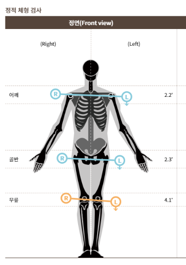 치료 전 체형 사진