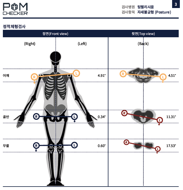 폼체커(체형분석기) 좌우 불균형 컨텐츠