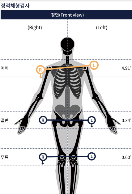 정면 체형 측정 리포트