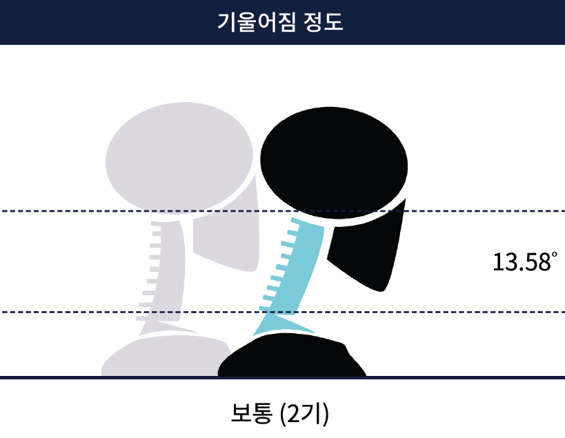 폼체커(AI 체형분석기) 결과리포트 중 일부