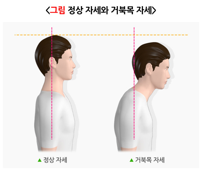 출처 : 질병관리청