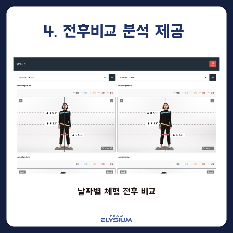폼체커 전후비교 분석 제공