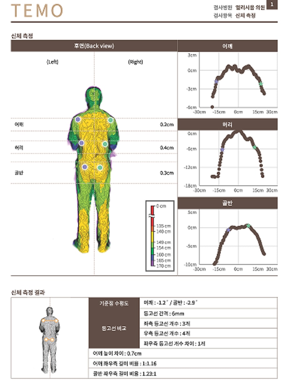 경근무늬 측정 검사